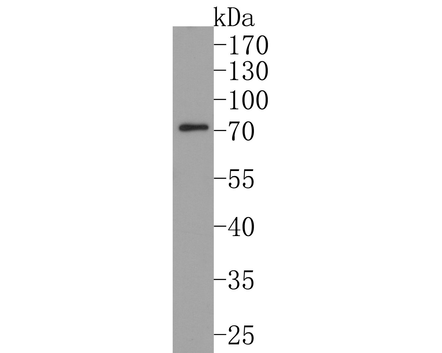 Western blot analysis of STAM1 on mouse small intestine tissue lysates. Proteins were transferred to a PVDF membrane and blocked with 5% BSA in PBS for 1 hour at room temperature. The primary antibody (HA500166, 1/500) was used in 5% BSA at room temperature for 2 hours. Goat Anti-Rabbit IgG - HRP Secondary Antibody (HA1001) at 1:200,000 dilution was used for 1 hour at room temperature.<br />
<br />
Predicted band size: 59 kDa<br />
Observed band size: 70 kDa