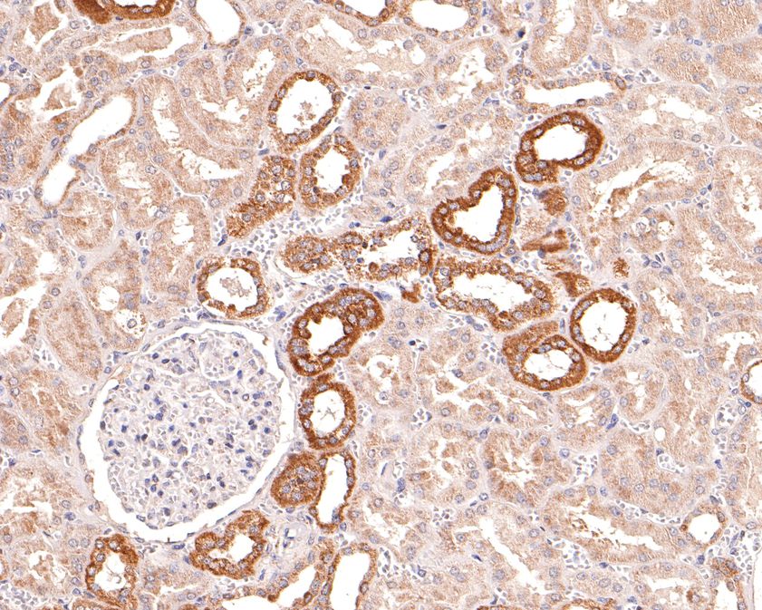 Immunohistochemical analysis of paraffin-embedded human kidney tissue using anti-STAM1 antibody. The section was pre-treated using heat mediated antigen retrieval with Tris-EDTA buffer (pH 9.0) for 20 minutes.The tissues were blocked in 1% BSA for 30 minutes at room temperature, washed with ddH2O and PBS, and then probed with the primary antibody (HA500166, 1/600) for 30 minutes at room temperature. The detection was performed using an HRP conjugated compact polymer system. DAB was used as the chromogen. Tissues were counterstained with hematoxylin and mounted with DPX.
