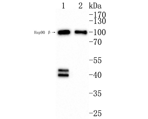 Western blot analysis of Erk1 (pT202/pY204) + Erk2 (pT185/pY187) on different lysates. Proteins were transferred to a PVDF membrane and blocked with 5% BSA in PBS for 1 hour at room temperature. The primary antibody (ET1610-13, 1/500) was used in 5% BSA at room temperature for 2 hours. Goat Anti-Rabbit IgG - HRP Secondary Antibody (HA1001) at 1:200,000 dilution was used for 1 hour at room temperature. <br />
Positive control: <br />
Lane 1: Untreated SK-Br-3 whole cell lysates<br />
Lane 2: SK-Br-3 treated with λ Protein Phosphatase whole cell lysates