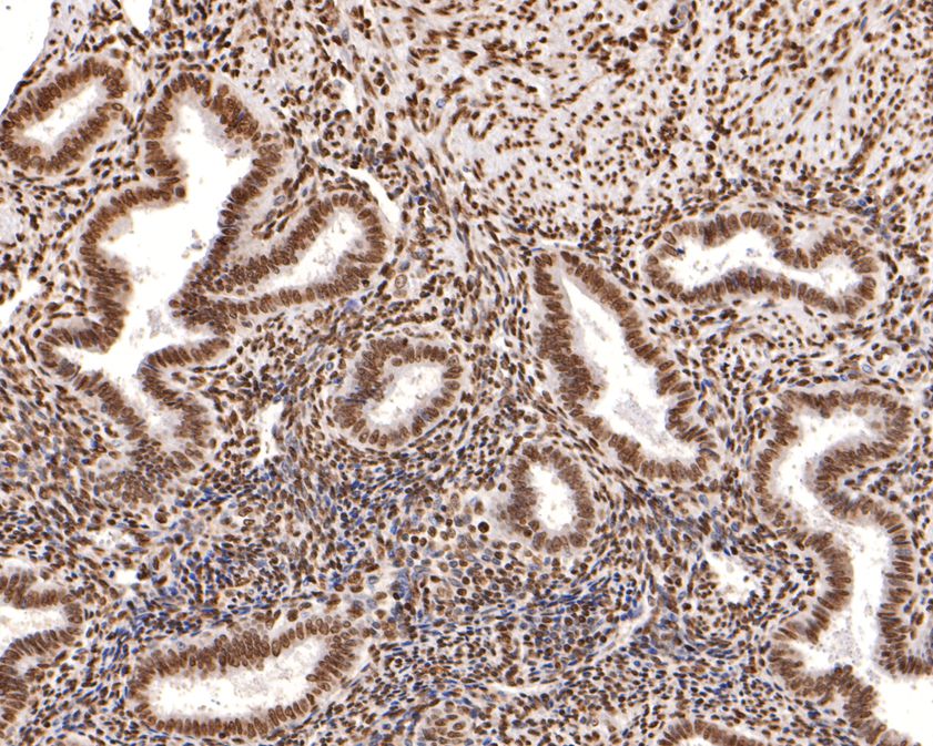 Immunohistochemical analysis of paraffin-embedded human uterus tissue using anti-Phospho-Estrogen Receptor alpha(S118) antibody. The section was pre-treated using heat mediated antigen retrieval with sodium citrate buffer (pH 6.0) for 20 minutes. The tissues were blocked in 1% BSA for 30 minutes at room temperature, washed with ddH2O and PBS, and then probed with the primary antibody (ET1610-32, 1/400)  for 30 minutes at room temperature. The detection was performed using an HRP conjugated compact polymer system. DAB was used as the chromogen. Tissues were counterstained with hematoxylin and mounted with DPX.