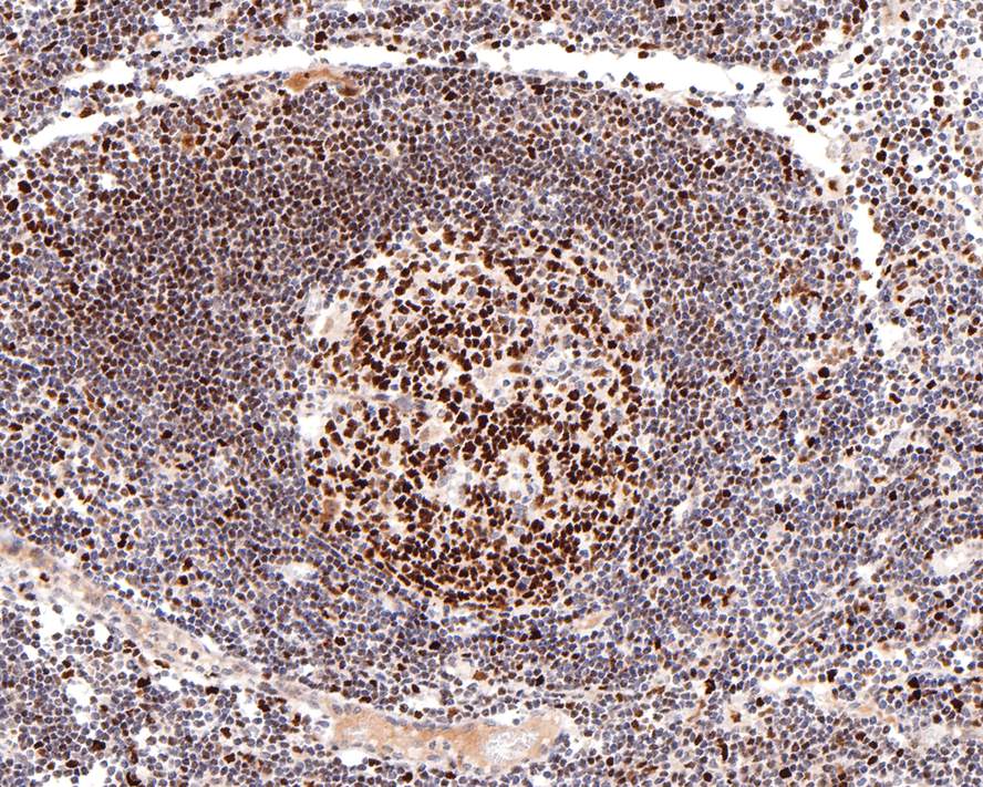 Immunohistochemical analysis of paraffin-embedded human esophagus tissue using anti-SMARCC1 antibody. The section was pre-treated using heat mediated antigen retrieval with sodium citrate buffer (pH 6.0) for 20 minutes. The tissues were blocked in 1% BSA for 30 minutes at room temperature, washed with ddH2O and PBS, and then probed with the primary antibody (ET7107-12, 1/400)  for 30 minutes at room temperature. The detection was performed using an HRP conjugated compact polymer system. DAB was used as the chromogen. Tissues were counterstained with hematoxylin and mounted with DPX.