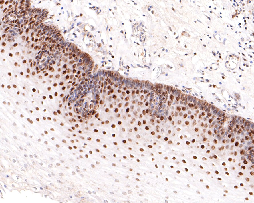 Immunohistochemical analysis of paraffin-embedded human small intestine tissue using anti-SMARCC1 antibody. The section was pre-treated using heat mediated antigen retrieval with sodium citrate buffer (pH 6.0) for 20 minutes. The tissues were blocked in 1% BSA for 30 minutes at room temperature, washed with ddH2O and PBS, and then probed with the primary antibody (ET7107-12, 1/400)  for 30 minutes at room temperature. The detection was performed using an HRP conjugated compact polymer system. DAB was used as the chromogen. Tissues were counterstained with hematoxylin and mounted with DPX.