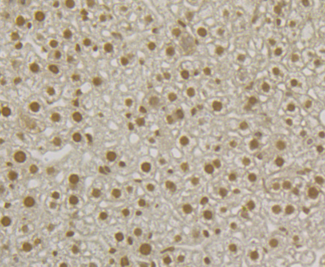 Immunohistochemical analysis of paraffin-embedded mouse liver tissue using anti-U1A antibody. The section was pre-treated using heat mediated antigen retrieval with Tris-EDTA buffer (pH 9.0) for 20 minutes.The tissues were blocked in 5% BSA for 30 minutes at room temperature, washed with ddH2O and PBS, and then probed with the primary antibody (ET7107-98, 1/50) for 30 minutes at room temperature. The detection was performed using an HRP conjugated compact polymer system. DAB was used as the chromogen. Tissues were counterstained with hematoxylin and mounted with DPX.