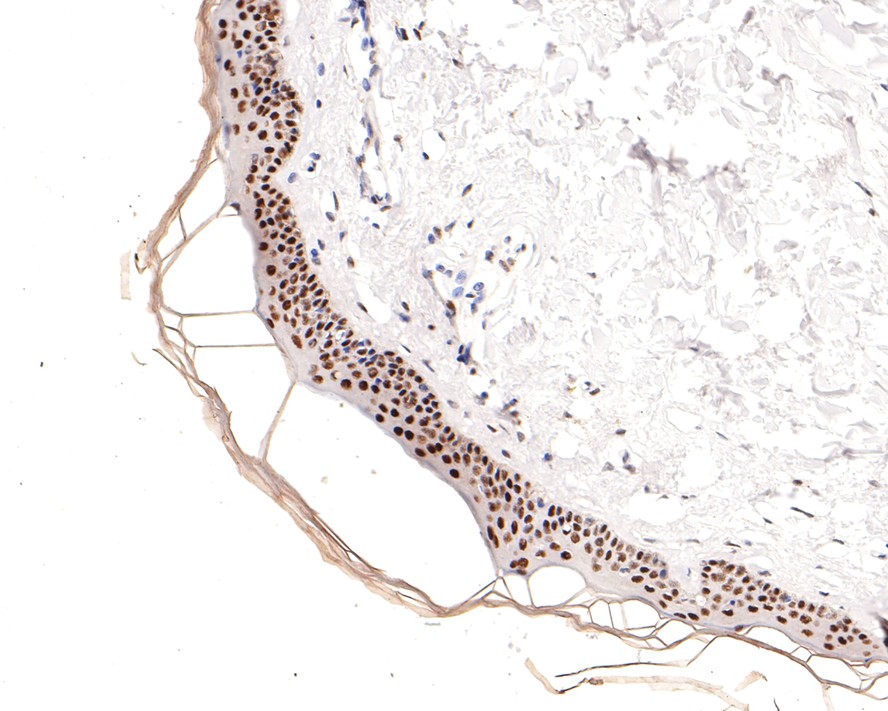 Immunohistochemical analysis of paraffin-embedded human skin tissue using anti-Retinoid X Receptor alpha antibody. The section was pre-treated using heat mediated antigen retrieval with sodium citrate buffer (pH 6.0) for 20 minutes. The tissues were blocked in 1% BSA for 30 minutes at room temperature, washed with ddH2O and PBS, and then probed with the primary antibody (ET7108-99, 1/400)  for 30 minutes at room temperature. The detection was performed using an HRP conjugated compact polymer system. DAB was used as the chromogen. Tissues were counterstained with hematoxylin and mounted with DPX.