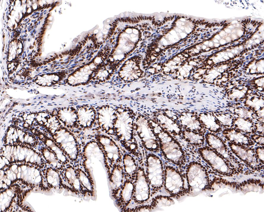 Immunohistochemical analysis of paraffin-embedded rat colon tissue using anti-BRD2 antibody. The section was pre-treated using heat mediated antigen retrieval with sodium citrate buffer (pH 6.0) for 20 minutes. The tissues were blocked in 1% BSA for 30 minutes at room temperature, washed with ddH2O and PBS, and then probed with the primary antibody (ET7109-07, 1/400)  for 30 minutes at room temperature. The detection was performed using an HRP conjugated compact polymer system. DAB was used as the chromogen. Tissues were counterstained with hematoxylin and mounted with DPX.