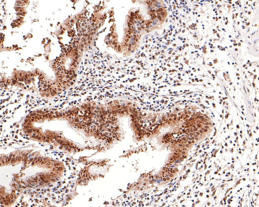 Immunohistochemical analysis of paraffin-embedded human gallbladder tissue using anti-BRD2 antibody. The section was pre-treated using heat mediated antigen retrieval with sodium citrate buffer (pH 6.0) for 20 minutes. The tissues were blocked in 1% BSA for 30 minutes at room temperature, washed with ddH2O and PBS, and then probed with the primary antibody (ET7109-07, 1/100)  for 30 minutes at room temperature. The detection was performed using an HRP conjugated compact polymer system. DAB was used as the chromogen. Tissues were counterstained with hematoxylin and mounted with DPX.