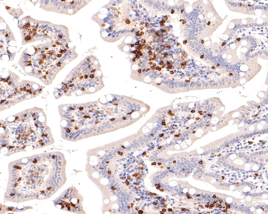 Immunohistochemical analysis of paraffin-embedded human small intestine tissue using anti-Integrin alpha E antibody. The section was pre-treated using heat mediated antigen retrieval with Tris-EDTA buffer (pH 9.0) for 20 minutes.The tissues were blocked in 1% BSA for 30 minutes at room temperature, washed with ddH2O and PBS, and then probed with the primary antibody (ET1611-27, 1/400) for 30 minutes at room temperature. The detection was performed using an HRP conjugated compact polymer system. DAB was used as the chromogen. Tissues were counterstained with hematoxylin and mounted with DPX.