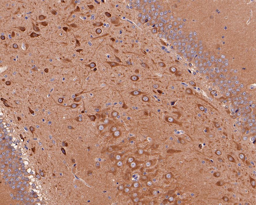Immunohistochemical analysis of paraffin-embedded rat brain tissue with Rabbit anti-Phospho-GSK3 (alpha+beta) (Y216+Y279) antibody (ET1607-54) at 1/800 dilution.<br />
<br />
The section was pre-treated using heat mediated antigen retrieval with sodium citrate buffer (pH 6.0) for 2 minutes. The tissues were blocked in 1% BSA for 20 minutes at room temperature, washed with ddH2O and PBS, and then probed with the primary antibody (ET1607-54) at 1/800 dilution for 1 hour at room temperature. The detection was performed using an HRP conjugated compact polymer system. DAB was used as the chromogen. Tissues were counterstained with hematoxylin and mounted with DPX.