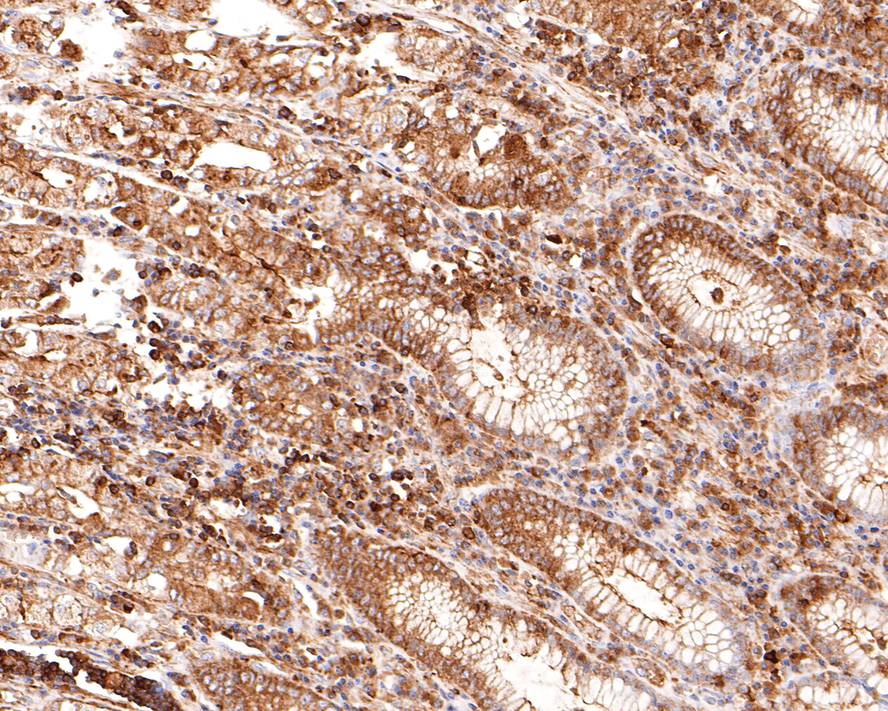 Immunohistochemical analysis of paraffin-embedded human stomach tissue using anti-ABCF1 antibody. The section was pre-treated using heat mediated antigen retrieval with sodium citrate buffer (pH 6.0) for 20 minutes. The tissues were blocked in 1% BSA for 30 minutes at room temperature, washed with ddH2O and PBS, and then probed with the primary antibody (ET1611-63, 1/400)  for 30 minutes at room temperature. The detection was performed using an HRP conjugated compact polymer system. DAB was used as the chromogen. Tissues were counterstained with hematoxylin and mounted with DPX.