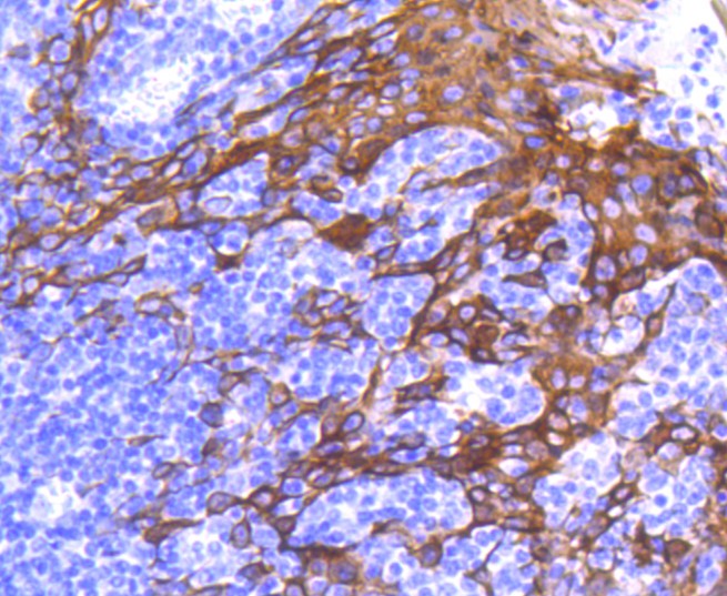 Immunohistochemical analysis of paraffin-embedded human tonsil tissue using anti-Cytokeratin 6 antibody. The section was pre-treated using heat mediated antigen retrieval with Tris-EDTA buffer (pH 9.0) for 20 minutes.The tissues were blocked in 1% BSA for 30 minutes at room temperature, washed with ddH2O and PBS, and then probed with the primary antibody (ET1611-70, 1/50) for 30 minutes at room temperature. The detection was performed using an HRP conjugated compact polymer system. DAB was used as the chromogen. Tissues were counterstained with hematoxylin and mounted with DPX.