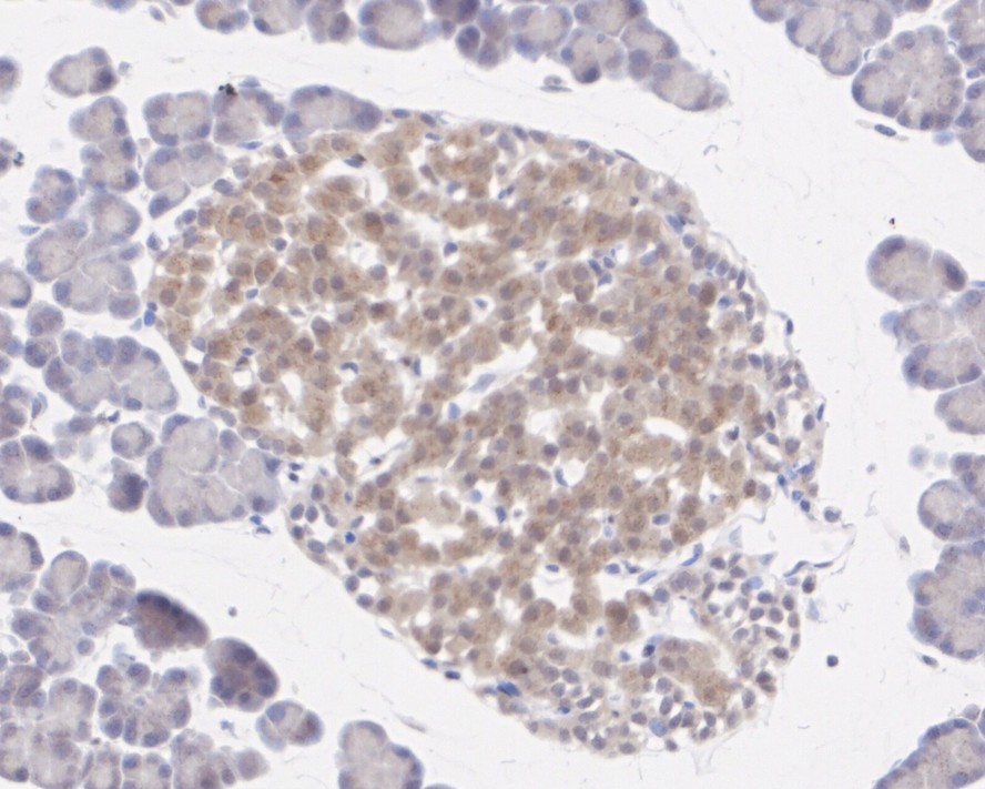 Immunohistochemical analysis of paraffin-embedded rat brain tissue with Rabbit anti-PTEN antibody (ET1606-43) at 1/1,000 dilution.<br />
<br />
The section was pre-treated using heat mediated antigen retrieval with Tris-EDTA buffer (pH 9.0) for 20 minutes. The tissues were blocked in 1% BSA for 20 minutes at room temperature, washed with ddH2O and PBS, and then probed with the primary antibody (ET1606-43) at 1/1,000 dilution for 1 hour at room temperature. The detection was performed using an HRP conjugated compact polymer system. DAB was used as the chromogen. Tissues were counterstained with hematoxylin and mounted with DPX.