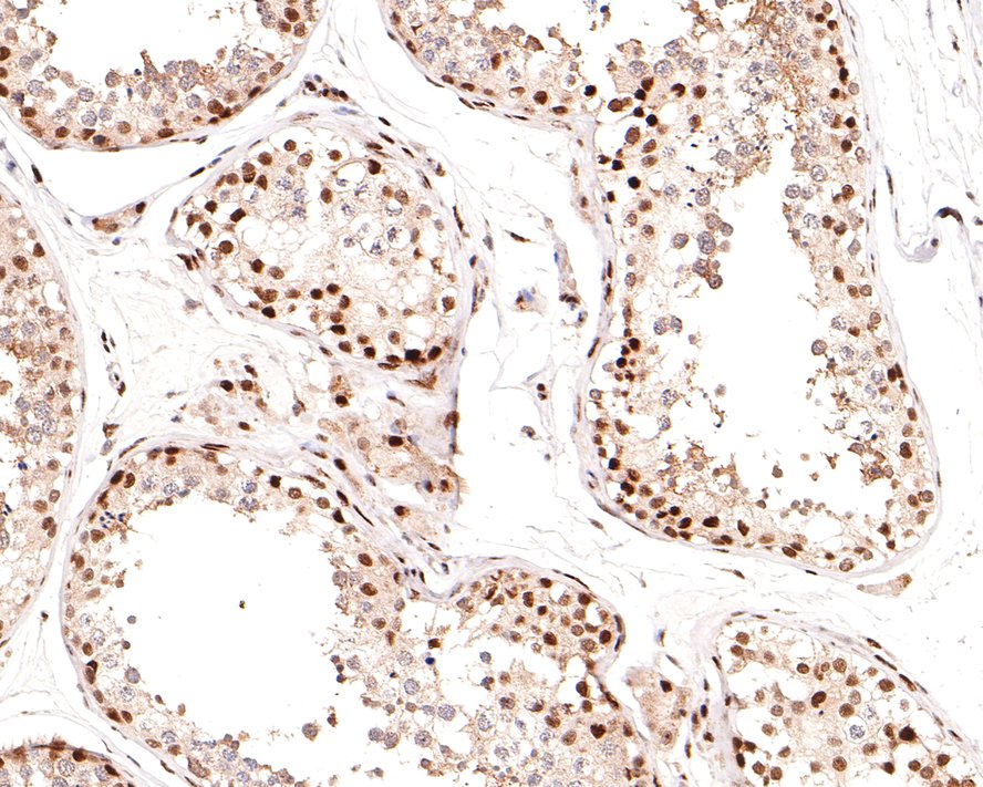 Immunohistochemical analysis of paraffin-embedded human testis tissue using anti-Phospho-Cyclin E1(T77) antibody. The section was pre-treated using heat mediated antigen retrieval with sodium citrate buffer (pH 6.0) for 20 minutes. The tissues were blocked in 1% BSA for 30 minutes at room temperature, washed with ddH2O and PBS, and then probed with the primary antibody (ET1612-31, 1/400)  for 30 minutes at room temperature. The detection was performed using an HRP conjugated compact polymer system. DAB was used as the chromogen. Tissues were counterstained with hematoxylin and mounted with DPX.
