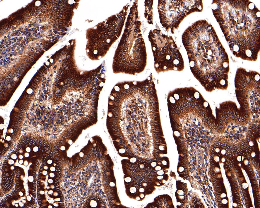 Immunohistochemical analysis of paraffin-embedded human small intestine tissue using anti-ERAP1 antibody. The section was pre-treated using heat mediated antigen retrieval with Tris-EDTA buffer (pH 9.0) for 20 minutes.The tissues were blocked in 1% BSA for 30 minutes at room temperature, washed with ddH2O and PBS, and then probed with the primary antibody (ET7110-29, 1/400) for 30 minutes at room temperature. The detection was performed using an HRP conjugated compact polymer system. DAB was used as the chromogen. Tissues were counterstained with hematoxylin and mounted with DPX.