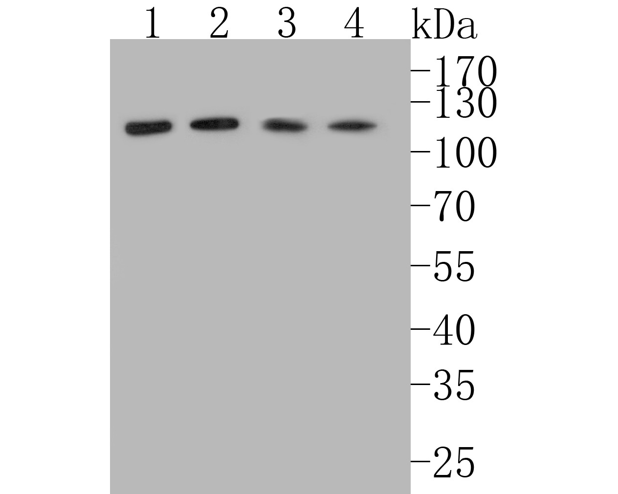 Western blot analysis of Fibulin 5 on different lysates. Proteins were transferred to a PVDF membrane and blocked with 5% BSA in PBS for 1 hour at room temperature. The primary antibody (HA600044, 1/500) was used in 5% BSA at room temperature for 2 hours. Goat Anti-Mouse IgG - HRP Secondary Antibody (HA1006) at 1:200,000 dilution was used for 1 hour at room temperature.<br />
Positive control: <br />
Lane 1: A549 cell lysate<br />
Lane 2: SKOV-3 cell lysate<br />
Lane 3: Hela cell lysate<br />
Lane 4: SiHa cell lysate<br />
<br />
Predicted band size: 50 kDa<br />
Observed band size: 110 kDa (Homodimer)