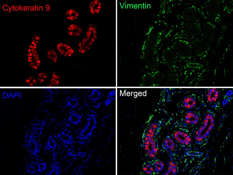 Immunofluorescence analysis of paraffin-embedded human breast tissue labeling Cytokeratin 9 (ET1612-77) and Vimentin (EM0401).<br />
<br />
The section was pre-treated using heat mediated antigen retrieval with Tris-EDTA buffer (pH 9.0) for 20 minutes. The tissues were blocked in 10% negative goat serum for 1 hour at room temperature, washed with PBS. And then probed with the primary antibodies Cytokeratin 9 (ET1612-77, red) at 1/50 dilution and Vimentin (EM0401, green) at 1/500 dilution at +4℃ overnight, washed with PBS.<br />
<br />
Goat Anti-Rabbit IgG H&L (iFluor™ 594, HA1122) and Goat Anti-Mouse IgG H&L (iFluor™ 488, HA1125) were used as the secondary antibodies at 1/1,000 dilution. Nuclei were counterstained with DAPI (blue).