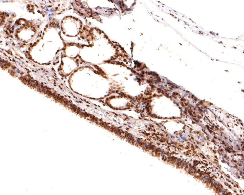 Immunohistochemical analysis of paraffin-embedded rat trachea tissue using anti-Phospho-Raf1(S621) antibody. The section was pre-treated using heat mediated antigen retrieval with sodium citrate buffer (pH 6.0) for 20 minutes. The tissues were blocked in 1% BSA for 30 minutes at room temperature, washed with ddH2O and PBS, and then probed with the primary antibody (ET1701-3, 1/400)  for 30 minutes at room temperature. The detection was performed using an HRP conjugated compact polymer system. DAB was used as the chromogen. Tissues were counterstained with hematoxylin and mounted with DPX.