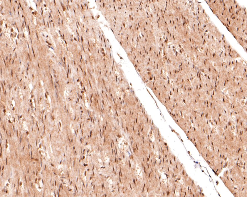 Immunohistochemical analysis of paraffin-embedded human muscle tissue using anti-Phospho-Raf1(S621) antibody. The section was pre-treated using heat mediated antigen retrieval with sodium citrate buffer (pH 6.0) for 20 minutes. The tissues were blocked in 1% BSA for 30 minutes at room temperature, washed with ddH2O and PBS, and then probed with the primary antibody (ET1701-3, 1/400)  for 30 minutes at room temperature. The detection was performed using an HRP conjugated compact polymer system. DAB was used as the chromogen. Tissues were counterstained with hematoxylin and mounted with DPX.
