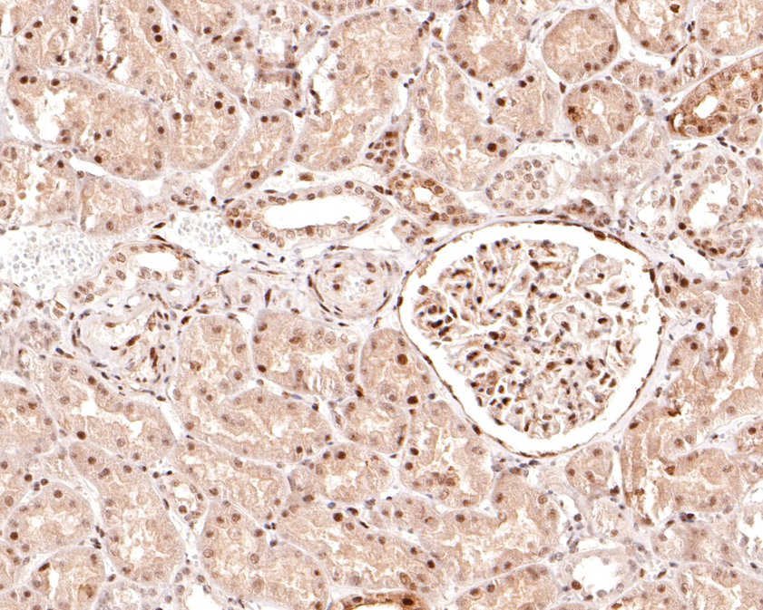 Immunohistochemical analysis of paraffin-embedded human kidney tissue using anti-Phospho-Raf1(S621) antibody. The section was pre-treated using heat mediated antigen retrieval with sodium citrate buffer (pH 6.0) for 20 minutes. The tissues were blocked in 1% BSA for 30 minutes at room temperature, washed with ddH2O and PBS, and then probed with the primary antibody (ET1701-3, 1/100)  for 30 minutes at room temperature. The detection was performed using an HRP conjugated compact polymer system. DAB was used as the chromogen. Tissues were counterstained with hematoxylin and mounted with DPX.