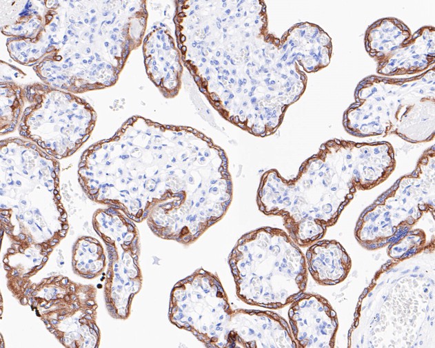 Immunofluorescence analysis of paraffin-embedded human kidney tissue labeling Cytokeratin 19 (ET1601-6).<br />
<br />
The section was pre-treated using heat mediated antigen retrieval with Tris-EDTA buffer (pH 9.0) for 20 minutes. The tissues were blocked in 10% negative goat serum for 1 hour at room temperature, washed with PBS. And then probed with the primary antibodies Cytokeratin 19 (ET1601-6, red) at 1/500 dilution at +4℃ overnight, washed with PBS.<br />
<br />
Goat Anti-Rabbit IgG H&L (iFluor™ 594, HA1122) was used as the secondary antibodies at 1/1,000 dilution. Nuclei were counterstained with DAPI (blue).