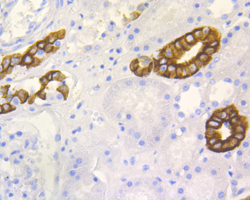 Immunohistochemical analysis of paraffin-embedded human kidney tissue using anti-Cytokeratin 19 antibody. The section was pre-treated using heat mediated antigen retrieval with Tris-EDTA buffer (pH 9.0) for 20 minutes.The tissues were blocked in 5% BSA for 30 minutes at room temperature, washed with ddH2O and PBS, and then probed with the primary antibody (ET1601-6, 1/100) for 30 minutes at room temperature. The detection was performed using an HRP conjugated compact polymer system. DAB was used as the chromogen. Tissues were counterstained with hematoxylin and mounted with DPX.
