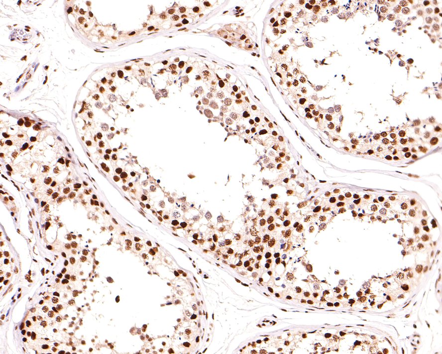 Immunohistochemical analysis of paraffin-embedded rat testis tissue using anti-ARID1A antibody. The section was pre-treated using heat mediated antigen retrieval with sodium citrate buffer (pH 6.0) for 20 minutes. The tissues were blocked in 1% BSA for 30 minutes at room temperature, washed with ddH2O and PBS, and then probed with the primary antibody (ET1701-60, 1/100)  for 30 minutes at room temperature. The detection was performed using an HRP conjugated compact polymer system. DAB was used as the chromogen. Tissues were counterstained with hematoxylin and mounted with DPX.