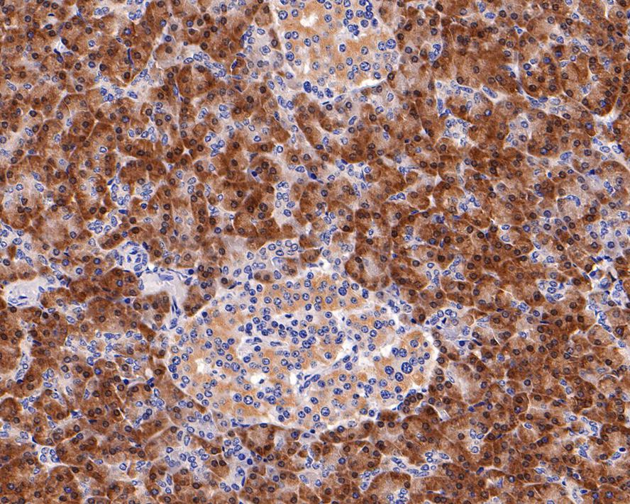 Immunohistochemical analysis of paraffin-embedded human pancreas tissue with Rabbit anti-Phospho-eIF4E (S209) antibody (ET1608-66) at 1/200 dilution.<br />
<br />
The section was pre-treated using heat mediated antigen retrieval with Tris-EDTA buffer (pH 9.0) for 20 minutes. The tissues were blocked in 1% BSA for 20 minutes at room temperature, washed with ddH2O and PBS, and then probed with the primary antibody (ET1608-66) at 1/200 dilution for 1 hour at room temperature. The detection was performed using an HRP conjugated compact polymer system. DAB was used as the chromogen. Tissues were counterstained with hematoxylin and mounted with DPX.