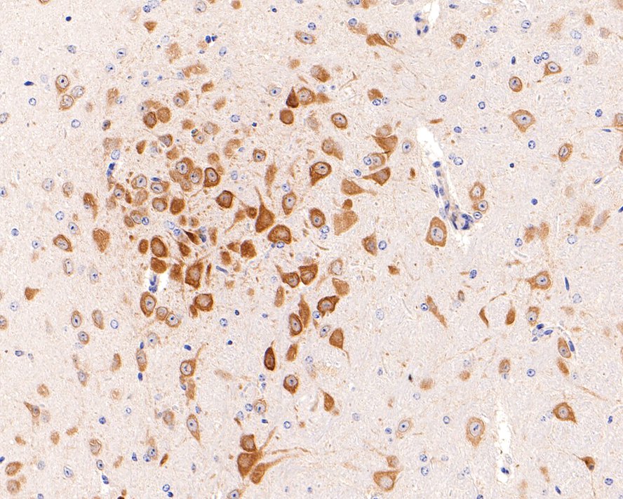 Immunohistochemical analysis of paraffin-embedded mouse brain tissue with Rabbit anti-Phospho-eIF4E (S209) antibody (ET1608-66) at 1/200 dilution.<br />
<br />
The section was pre-treated using heat mediated antigen retrieval with Tris-EDTA buffer (pH 9.0) for 20 minutes. The tissues were blocked in 1% BSA for 20 minutes at room temperature, washed with ddH2O and PBS, and then probed with the primary antibody (ET1608-66) at 1/200 dilution for 1 hour at room temperature. The detection was performed using an HRP conjugated compact polymer system. DAB was used as the chromogen. Tissues were counterstained with hematoxylin and mounted with DPX.