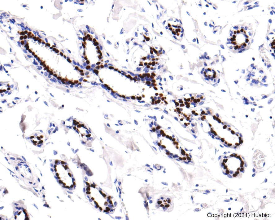 Immunohistochemical analysis of paraffin-embedded human smooth muscle tissue using anti-Progesterone Receptor antibody. The section was pre-treated using heat mediated antigen retrieval with sodium citrate buffer (pH 6.0) for 20 minutes. The tissues were blocked in 5% BSA for 30 minutes at room temperature, washed with ddH2O and PBS, and then probed with the primary antibody (ET1702-24, 1/100)  for 30 minutes at room temperature. The detection was performed using an HRP conjugated compact polymer system. DAB was used as the chromogen. Tissues were counterstained with hematoxylin and mounted with DPX.