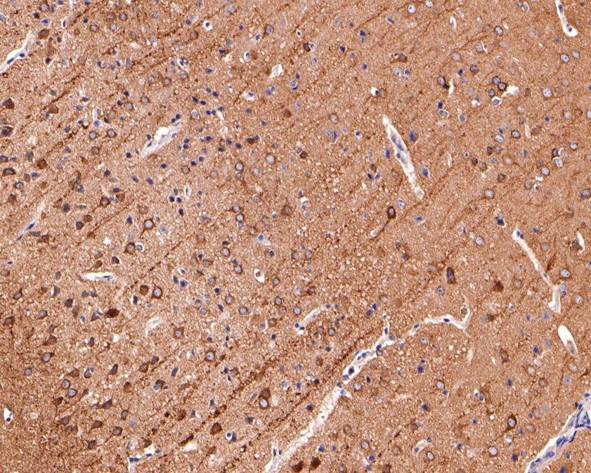 Immunohistochemical analysis of paraffin-embedded mouse brain tissue using anti-THY1 antibody. The section was pre-treated using heat mediated antigen retrieval with Tris-EDTA buffer (pH 9.0) for 20 minutes.The tissues were blocked in 1% BSA for 30 minutes at room temperature, washed with ddH2O and PBS, and then probed with the primary antibody (ET1702-92, 1/400) for 30 minutes at room temperature. The detection was performed using an HRP conjugated compact polymer system. DAB was used as the chromogen. Tissues were counterstained with hematoxylin and mounted with DPX.