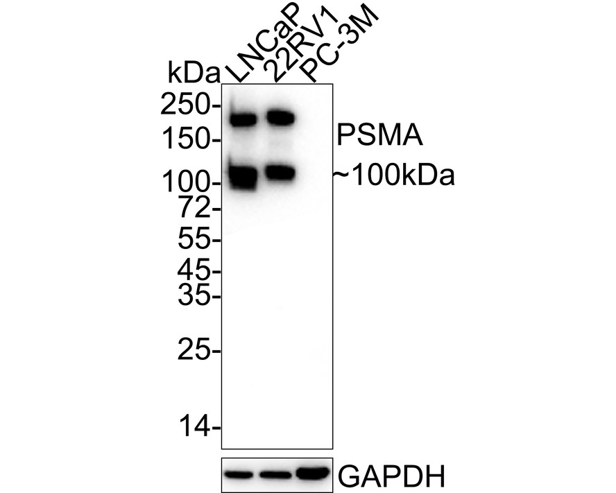 Western blot analysis of PSMA on different lysates with Mouse anti-PSMA antibody (HA600045) at 1/1,000 dilution.<br />
<br />
Lane 1: LNCaP cell lysate<br />
Lane 2: 22RV1 cell lysate<br />
Lane 3: PC-3M cell lysate (negative)<br />
<br />
Lysates/proteins at 20 µg/Lane.<br />
<br />
Predicted band size: 84 kDa<br />
Observed band size: 100/200 kDa<br />
<br />
Exposure time: 15 seconds;<br />
<br />
4-20% SDS-PAGE gel.<br />
<br />
Proteins were transferred to a PVDF membrane and blocked with 5% NFDM/TBST for 1 hour at room temperature. The primary antibody (HA600045) at 1/1,000 dilution was used in 5% NFDM/TBST at 4℃ overnight. Goat Anti-Mouse IgG - HRP Secondary Antibody (HA1006) at 1/50,000 dilution was used for 1 hour at room temperature.
