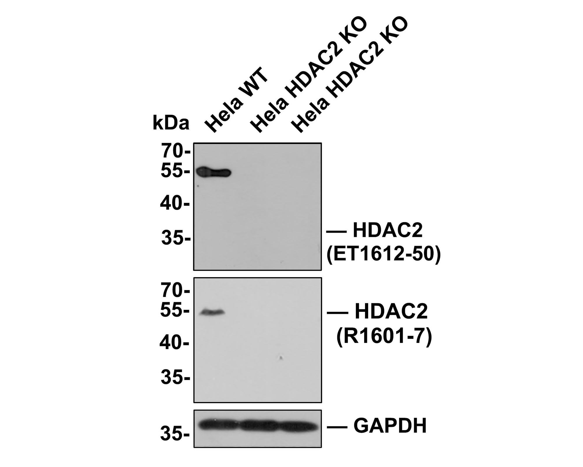 All lanes: Western blot analysis of HDAC2 with anti-HDAC2 antibody (ET1612-50) at 1:500 dilution.<br />
Lane 1: Wild-type Hela whole cell lysate (10 µg).<br />
Lane 2/3: HDAC2 knockout Hela whole cell lysate (10 µg).<br />
<br />
ET1612-50 was shown to specifically react with HDAC2 in wild-type Hela cells. No bands were observed when HDAC2 knockout sample were tested. Wild-type and HDAC2 knockout samples were subjected to SDS-PAGE. Proteins were transferred to a PVDF membrane and blocked with 5% NFDM in TBST for 1 hour at room temperature. The primary antibody (ET1612-50, 1:500) was used in 5% BSA at room temperature for 2 hours. Goat Anti-Rabbit IgG-HRP Secondary Antibody (HA1001) at 1:300,000 dilution was used for 1 hour at room temperature.