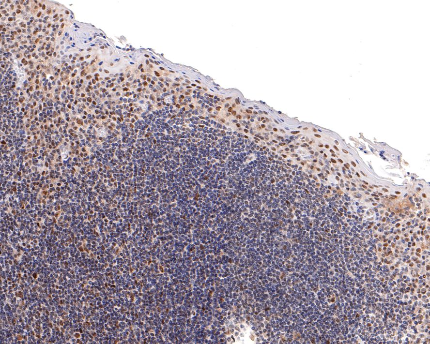 Immunohistochemical analysis of paraffin-embedded human tonsil tissue with Rabbit anti-HDAC2 antibody (ET1612-50) at 1/200 dilution.<br />
<br />
The section was pre-treated using heat mediated antigen retrieval with sodium citrate buffer (pH 6.0) for 2 minutes. The tissues were blocked in 1% BSA for 20 minutes at room temperature, washed with ddH2O and PBS, and then probed with the primary antibody (ET1612-50) at 1/200 dilution for 1 hour at room temperature. The detection was performed using an HRP conjugated compact polymer system. DAB was used as the chromogen. Tissues were counterstained with hematoxylin and mounted with DPX.