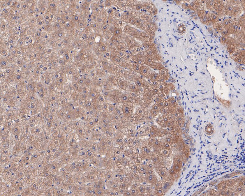 Immunohistochemical analysis of paraffin-embedded human liver tissue using anti-AK3L1 antibody. The section was pre-treated using heat mediated antigen retrieval with Tris-EDTA buffer (pH 8.0-8.4) for 20 minutes.The tissues were blocked in 5% BSA for 30 minutes at room temperature, washed with ddH2O and PBS, and then probed with the primary antibody (HA720036, 1/50) for 30 minutes at room temperature. The detection was performed using an HRP conjugated compact polymer system. DAB was used as the chromogen. Tissues were counterstained with hematoxylin and mounted with DPX.