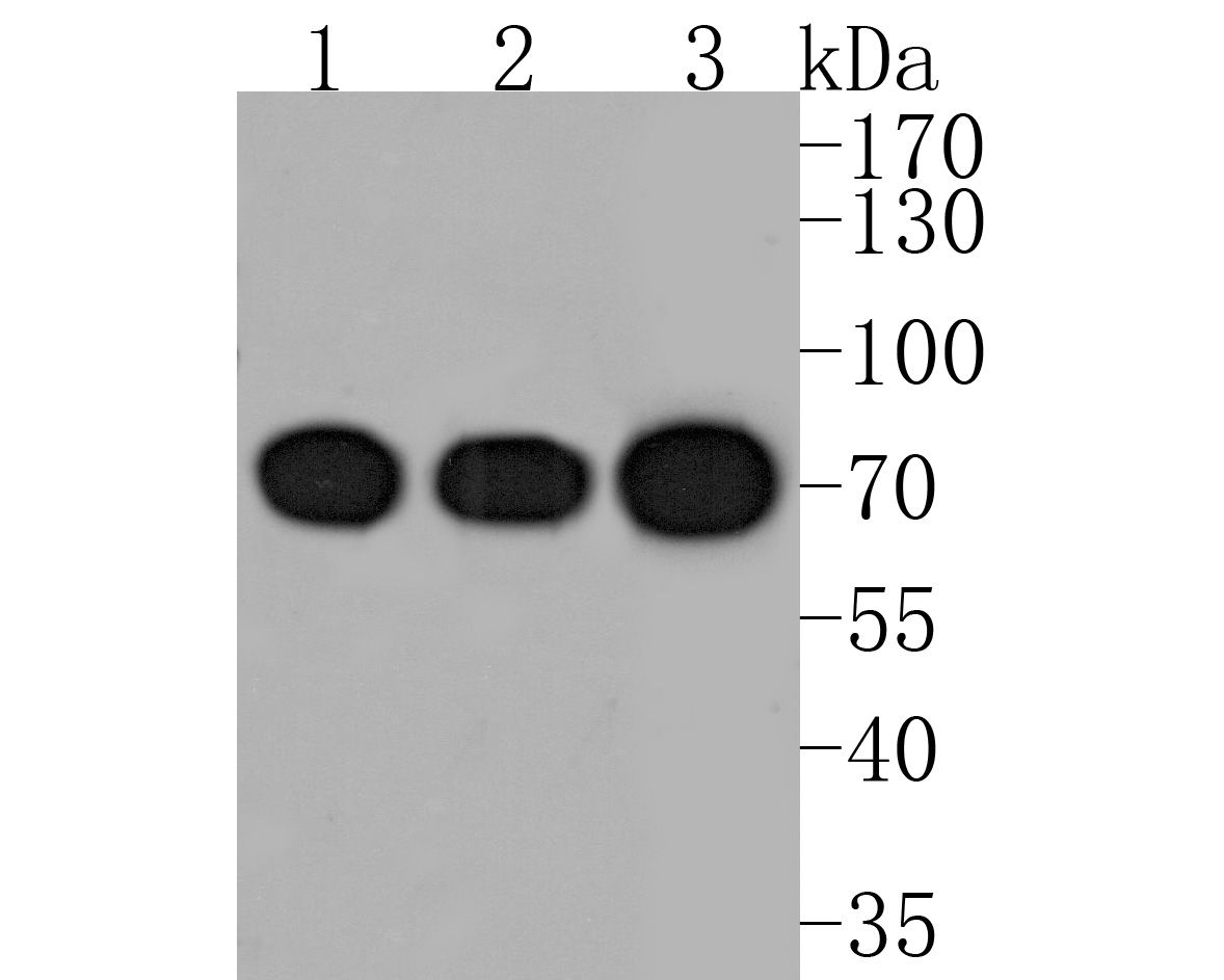 Western blot analysis of Glucosidase 2 subunit beta on different lysates. Proteins were transferred to a PVDF membrane and blocked with 5% BSA in PBS for 1 hour at room temperature. The primary antibody (HA720042, 1/500) was used in 5% BSA at room temperature for 2 hours. Goat Anti-Rabbit IgG - HRP Secondary Antibody (HA1001) at 1:200,000 dilution was used for 1 hour at room temperature.<br />
Positive control: <br />
Lane 1: Hela cell lysate<br />
Lane 2: A431 cell lysate<br />
Lane 3: MCF-7 cell lysate