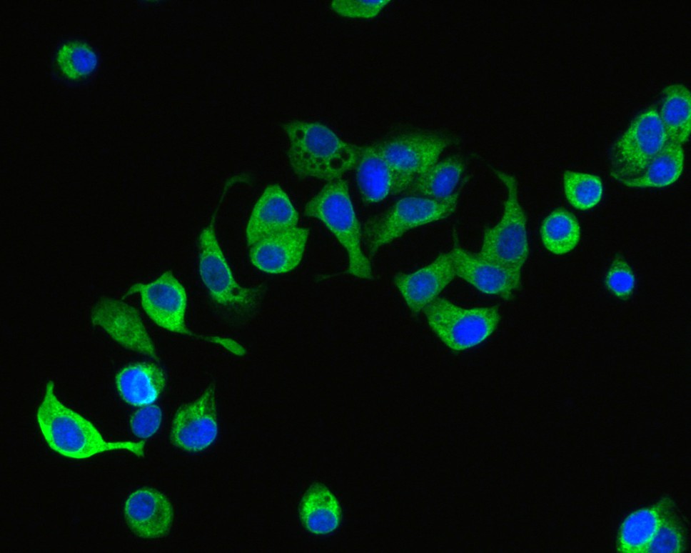ICC staining of Glucosidase 2 subunit beta in MCF-7 cells (green). Formalin fixed cells were permeabilized with 0.1% Triton X-100 in TBS for 10 minutes at room temperature and blocked with 1% Blocker BSA for 15 minutes at room temperature. Cells were probed with the primary antibody (HA720042, 1/200) for 1 hour at room temperature, washed with PBS. Alexa Fluor®488 Goat anti-Rabbit IgG was used as the secondary antibody at 1/1,000 dilution. The nuclear counter stain is DAPI (blue).