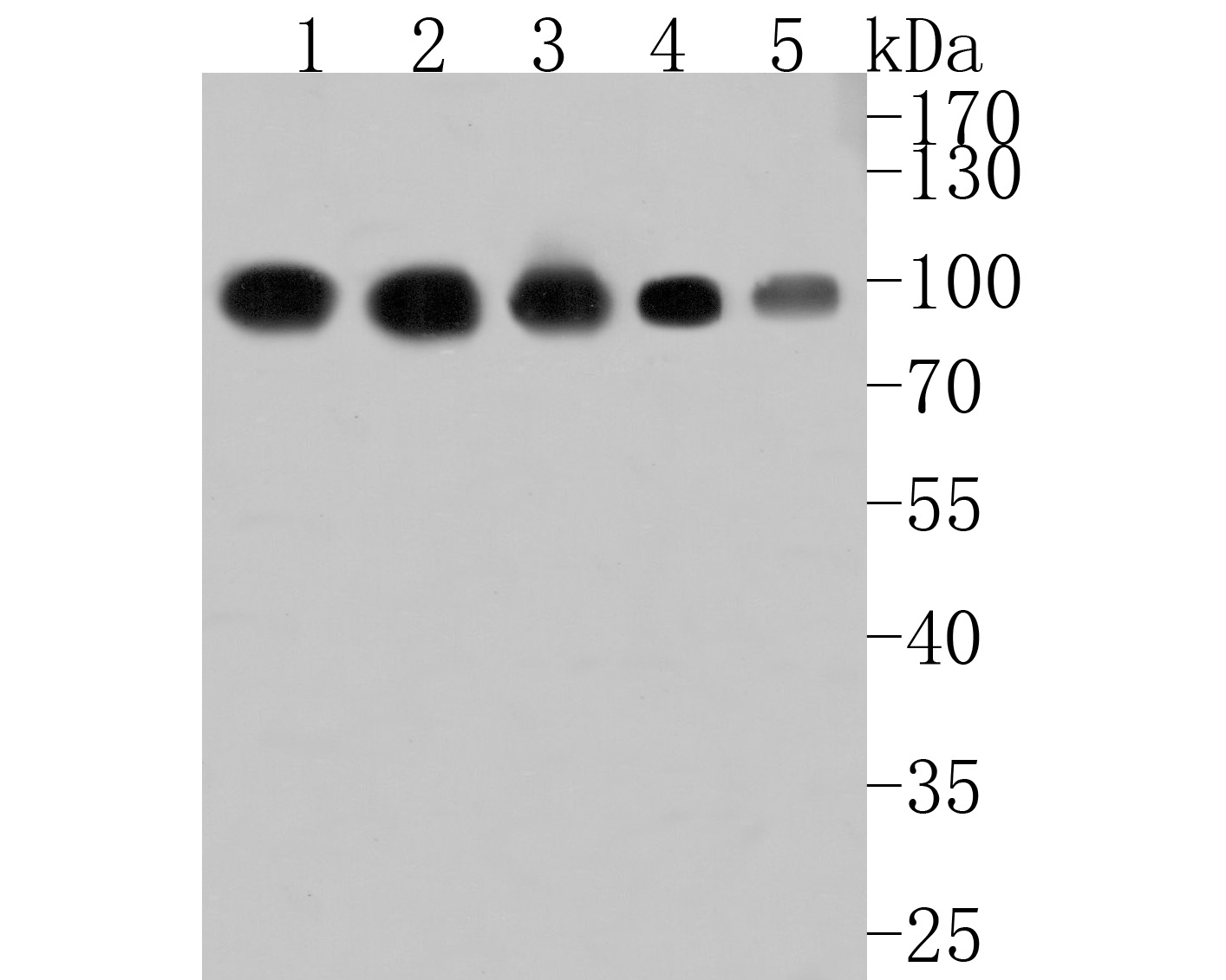 Western blot analysis of Glucosidase 2 subunit beta on different lysates. Proteins were transferred to a PVDF membrane and blocked with 5% BSA in PBS for 1 hour at room temperature. The primary antibody (HA500152, 1/1,000) was used in 5% BSA at room temperature for 2 hours. Goat Anti-Rabbit IgG - HRP Secondary Antibody (HA1001) at 1:200,000 dilution was used for 1 hour at room temperature.<br />
Positive control: <br />
Lane 1: Hela cell lysate<br />
Lane 2: Jurkat cell lysate<br />
Lane 3: A431 cell lysate<br />
Lane 4: Rat kidney tissue lysate<br />
Lane 5: Rat liver tissue lysate