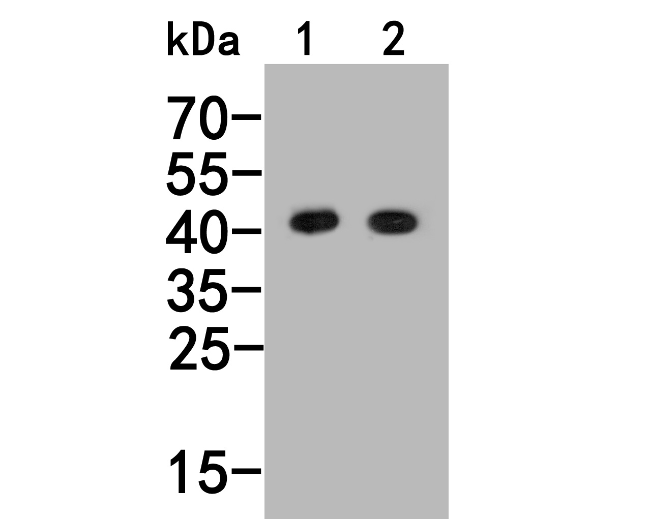 Western blot analysis of Histamine H2 receptor on different lysates. Proteins were transferred to a PVDF membrane and blocked with 5% BSA in PBS for 1 hour at room temperature. The primary antibody (HA500154, 1/1,000) was used in 5% BSA at room temperature for 2 hours. Goat Anti-Rabbit IgG - HRP Secondary Antibody (HA1001) at 1:200,000 dilution was used for 1 hour at room temperature.<br />
Positive control: <br />
Lane 1: PC-3M cell lysate<br />
Lane 2: SHSY5Y cell lysate
