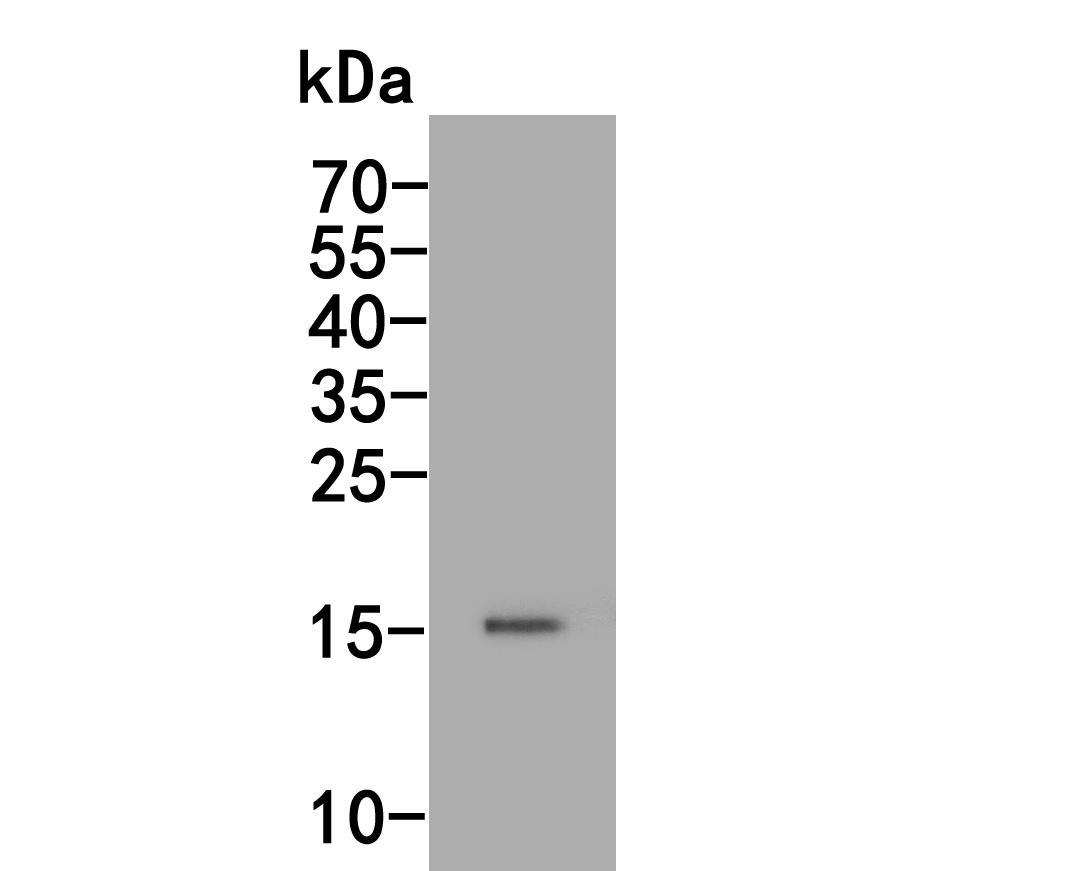 Western blot analysis of CDKN1A/P21 on mouse colon tissue lysate. Proteins were transferred to a PVDF membrane and blocked with 5% BSA in PBS for 1 hour at room temperature. The primary antibody (HA500156, 1/1,000) was used in 5% BSA at room temperature for 2 hours. Goat Anti-Rabbit IgG - HRP Secondary Antibody (HA1001) at 1:200,000 dilution was used for 1 hour at room temperature.