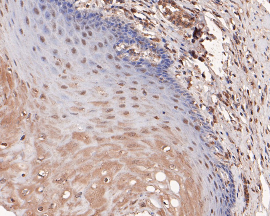 Immunohistochemical analysis of paraffin-embedded human esophagus tissue using anti-CDKN1A/P21 antibody. The section was pre-treated using heat mediated antigen retrieval with sodium citrate buffer (pH 6.0) for 20 minutes. The tissues were blocked in 5% BSA for 30 minutes at room temperature, washed with ddH2O and PBS, and then probed with the primary antibody (HA500156, 1/400)  for 30 minutes at room temperature. The detection was performed using an HRP conjugated compact polymer system. DAB was used as the chromogen. Tissues were counterstained with hematoxylin and mounted with DPX.