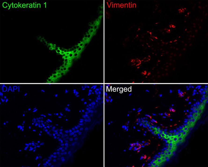 Immunofluorescence analysis of paraffin-embedded human skin tissue labeling Cytokeratin 1 (HA720127F) and Vimentin (EM0401).<br />
<br />
The section was pre-treated using heat mediated antigen retrieval with Tris-EDTA buffer (pH 9.0) for 20 minutes. The tissues were blocked in 10% negative goat serum for 1 hour at room temperature, washed with PBS. And then probed with the primary antibodies Cytokeratin 1 (HA720127F, green) at 1/500 dilution and Vimentin (EM0401, red) at 1/1,000 dilution overnight at 4 ℃, washed with PBS.<br />
<br />
iFluor™ 594 conjugate-Goat anti-Mouse IgG (HA1126) was used as the secondary antibody at 1/1,000 dilution. DAPI was used as nuclear counterstain.