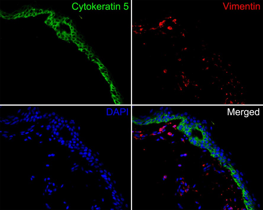 Immunofluorescence analysis of paraffin-embedded human skin tissue labeling Cytokeratin 5 (HA720129F) and Vimentin (EM0401).<br />
<br />
The section was pre-treated using heat mediated antigen retrieval with Tris-EDTA buffer (pH 9.0) for 20 minutes. The tissues were blocked in 10% negative goat serum for 1 hour at room temperature, washed with PBS. And then probed with the primary antibodies Cytokeratin 5 (HA720129F, green) at 1/200 dilution and Vimentin (EM0401, red) at 1/1,000 dilution overnight at 4 ℃, washed with PBS.<br />
<br />
iFluor™ 594 conjugate-Goat anti-Mouse IgG (HA1126) was used as the secondary antibody at 1/1,000 dilution. DAPI was used as nuclear counterstain.