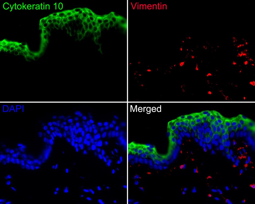 Immunofluorescence analysis of paraffin-embedded human skin tissue labeling Cytokeratin 10 (HA720134F) and Vimentin (EM0401).<br />
<br />
The section was pre-treated using heat mediated antigen retrieval with Tris-EDTA buffer (pH 9.0) for 20 minutes. The tissues were blocked in 10% negative goat serum for 1 hour at room temperature, washed with PBS. And then probed with the primary antibodies Cytokeratin 10 (HA720134F, green) at 1/500 dilution and Vimentin (EM0401, red) at 1/1,000 dilution overnight at 4 ℃, washed with PBS.<br />
<br />
iFluor™ 594 conjugate-Goat anti-Mouse IgG (HA1126) was used as the secondary antibody at 1/1,000 dilution. DAPI was used as nuclear counterstain.