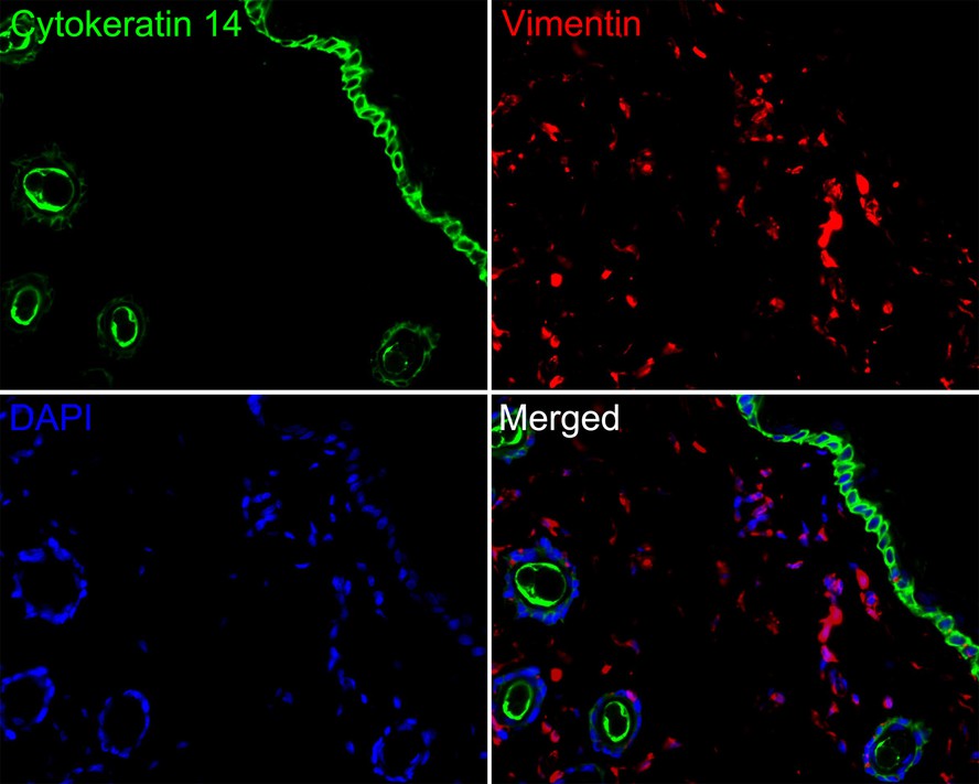 Immunofluorescence analysis of paraffin-embedded rat skin tissue labeling Cytokeratin 14 (HA720135F) and Vimentin (EM0401).<br />
<br />
The section was pre-treated using heat mediated antigen retrieval with Tris-EDTA buffer (pH 9.0) for 20 minutes. The tissues were blocked in 10% negative goat serum for 1 hour at room temperature, washed with PBS. And then probed with the primary antibodies Cytokeratin 14 (HA720135F, green) at 1/100 dilution and Vimentin (EM0401, red) at 1/1,000 dilution overnight at 4 ℃, washed with PBS.<br />
<br />
iFluor™ 594 conjugate-Goat anti-Mouse IgG (HA1126) was used as the secondary antibody at 1/1,000 dilution. DAPI was used as nuclear counterstain.