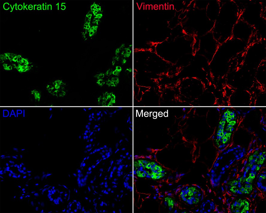 Immunofluorescence analysis of paraffin-embedded human breast tissue labeling Cytokeratin 15 (HA720136F) and Vimentin (EM0401).<br />
<br />
The section was pre-treated using heat mediated antigen retrieval with Tris-EDTA buffer (pH 9.0) for 20 minutes. The tissues were blocked in 10% negative goat serum for 1 hour at room temperature, washed with PBS. And then probed with the primary antibodies Cytokeratin 15 (HA720136F, green) at 1/400 dilution and Vimentin (EM0401, red) at 1/1,000 dilution overnight at 4 ℃, washed with PBS.<br />
<br />
iFluor™ 594 conjugate-Goat anti-Mouse IgG (HA1126) was used as the secondary antibody at 1/1,000 dilution. DAPI was used as nuclear counterstain.
