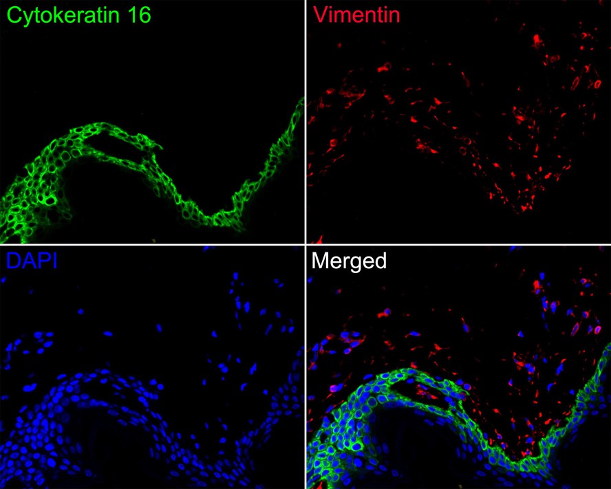Immunofluorescence analysis of paraffin-embedded human skin tissue labeling Cytokeratin 16 (HA720137F) and Vimentin (EM0401).<br />
<br />
The section was pre-treated using heat mediated antigen retrieval with Tris-EDTA buffer (pH 9.0) for 20 minutes. The tissues were blocked in 10% negative goat serum for 1 hour at room temperature, washed with PBS. And then probed with the primary antibodies Cytokeratin 16 (HA720137F, green) at 1/200 dilution and Vimentin (EM0401, red) at 1/1,000 dilution overnight at 4 ℃, washed with PBS.<br />
<br />
iFluor™ 594 conjugate-Goat anti-Mouse IgG (HA1126) was used as the secondary antibody at 1/1,000 dilution. DAPI was used as nuclear counterstain.