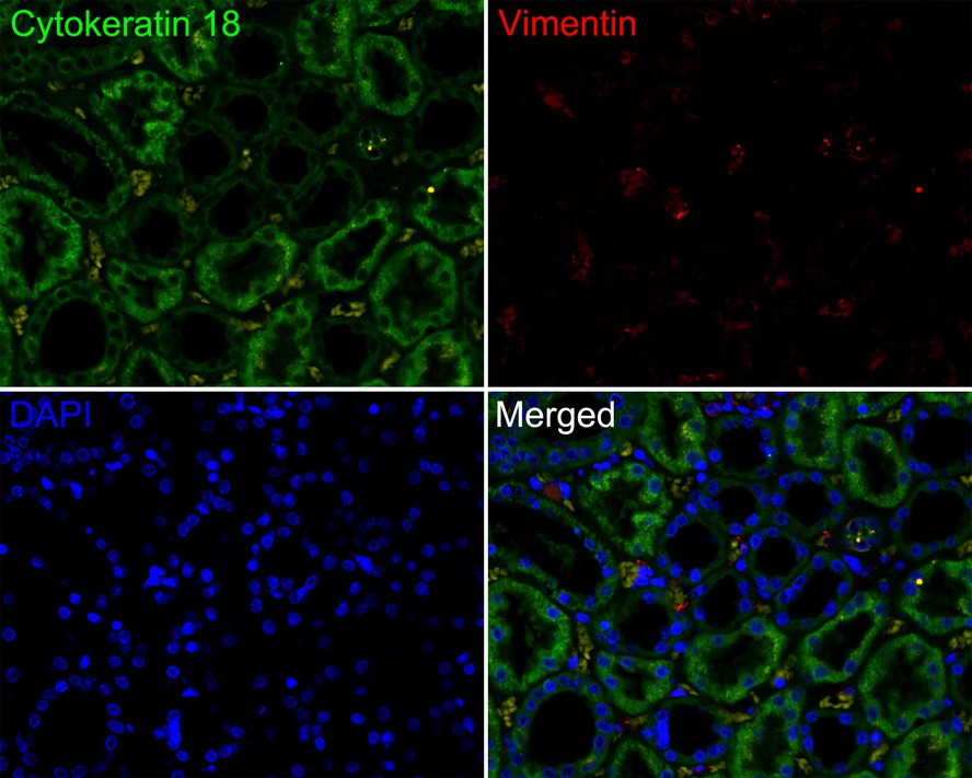 Immunofluorescence analysis of paraffin-embedded human kidney tissue labeling Cytokeratin 18 (HA720139F) and Vimentin (EM0401).<br />
<br />
The section was pre-treated using heat mediated antigen retrieval with Tris-EDTA buffer (pH 9.0) for 20 minutes. The tissues were blocked in 10% negative goat serum for 1 hour at room temperature, washed with PBS. And then probed with the primary antibodies Cytokeratin 18 (HA720139F, green) at 1/50 dilution and Vimentin (EM0401, red) at 1/1,000 dilution overnight at 4 ℃, washed with PBS.<br />
<br />
iFluor™ 594 conjugate-Goat anti-Mouse IgG (HA1126) was used as the secondary antibody at 1/1,000 dilution. DAPI was used as nuclear counterstain.
