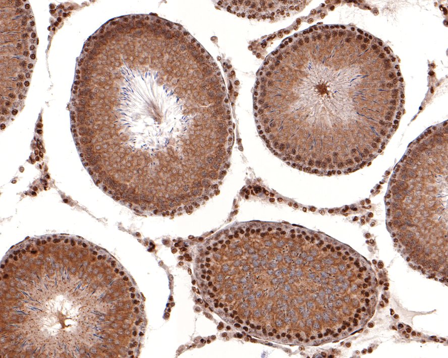 Immunohistochemical analysis of paraffin-embedded rat testis tissue with Rabbit anti-Lin28 antibody (ET1704-26) at 1/400 dilution.<br />
<br />
The section was pre-treated using heat mediated antigen retrieval with sodium citrate buffer (pH 6.0) for 2 minutes. The tissues were blocked in 1% BSA for 20 minutes at room temperature, washed with ddH2O and PBS, and then probed with the primary antibody (ET1704-26) at 1/400 dilution for 1 hour at room temperature. The detection was performed using an HRP conjugated compact polymer system. DAB was used as the chromogen. Tissues were counterstained with hematoxylin and mounted with DPX.
