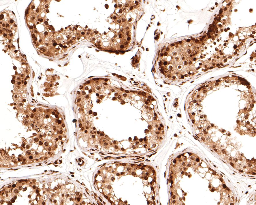 Immunohistochemical analysis of paraffin-embedded human testis tissue with Rabbit anti-Lin28 antibody (ET1704-26) at 1/400 dilution.<br />
<br />
The section was pre-treated using heat mediated antigen retrieval with sodium citrate buffer (pH 6.0) for 2 minutes. The tissues were blocked in 1% BSA for 20 minutes at room temperature, washed with ddH2O and PBS, and then probed with the primary antibody (ET1704-26) at 1/400 dilution for 1 hour at room temperature. The detection was performed using an HRP conjugated compact polymer system. DAB was used as the chromogen. Tissues were counterstained with hematoxylin and mounted with DPX.