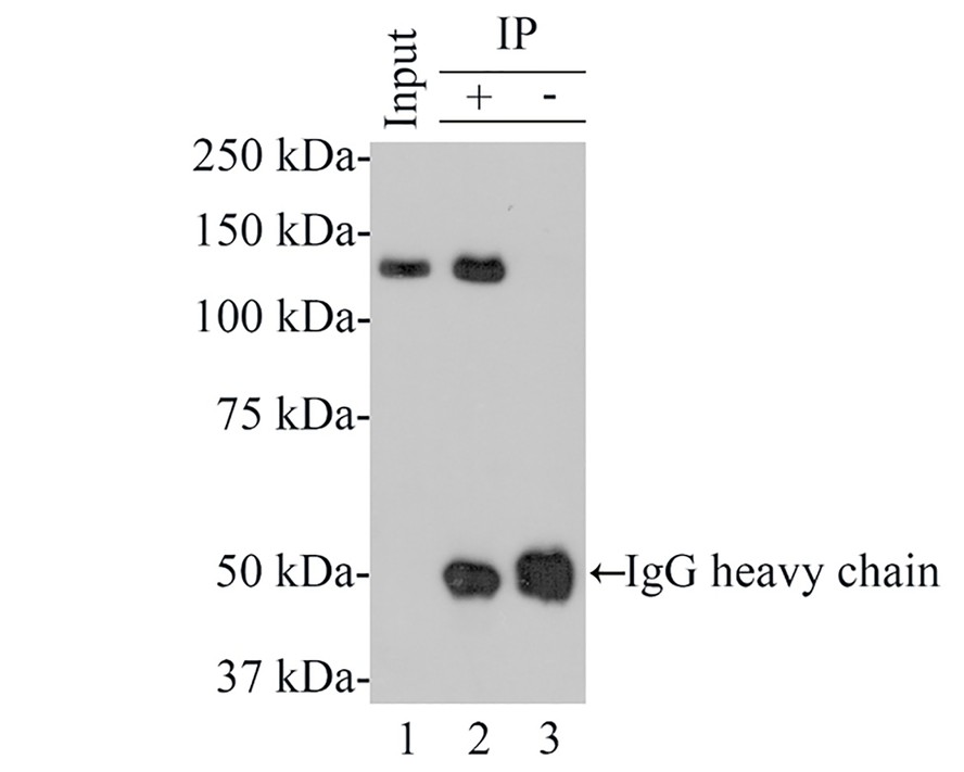 Bub1 was immunoprecipitated from 0.4 mg Hela whole cell lysates with HA600053 at 2 μg/mL. Western blot was performed from the immunoprecipitate using HA600053 at 1/500 dilution for 45 minutes at room temperature. Goat anti-Mouse IgG - HRP Secondary Antibody (HA1006) was used at 1:100,000 dilution for 30 minutes at room temperature.<br />
<br />
Lane 1: Hela whole cell lysates at 4 μg;<br />
Lane 2: Bub1 (HA600053) IP in Hela whole cell lysates;<br />
Lane 3: Mouse IgG instead of Bub1 (HA600053)  in Hela whole cell lysates.<br />
<br />
Predicted band size: 122 kDa<br />
Observed band size: 122 kDa<br />
<br />
Exposure time: 2 minutes;<br />
<br />
8% SDS-PAGE gel.