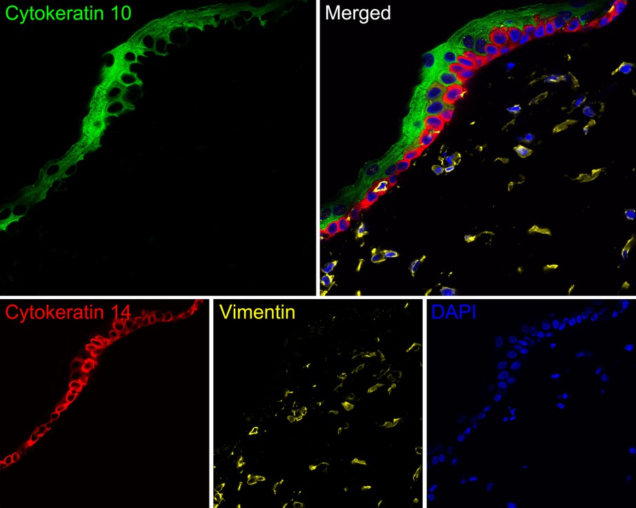 Immunofluorescence analysis of paraffin-embedded rat skin tissue labeling Cytokeratin 10 (HA720134F), Cytokeratin 14 (HA720147F) and Vimentin (EM0401).<br />
<br />
The section was pre-treated using heat mediated antigen retrieval with Tris-EDTA buffer (pH 9.0) for 20 minutes. The tissues were blocked in 10% negative goat serum for 1 hour at room temperature, washed with PBS. And then probed with the primary antibodies Cytokeratin 10 (HA720134F, green) at 1/400 dilution, Cytokeratin 14 (HA720147F, red) at 1/400 dilution and Vimentin (EM0401, yellow) at 1/1,000 dilution overnight at 4 ℃, washed with PBS.<br />
<br />
Alexa Fluor® 555 conjugate-Goat anti-Mouse IgG was used as the secondary antibody at 1/1,000 dilution. DAPI was used as nuclear counterstain.